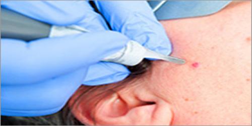 Department of Dermatology